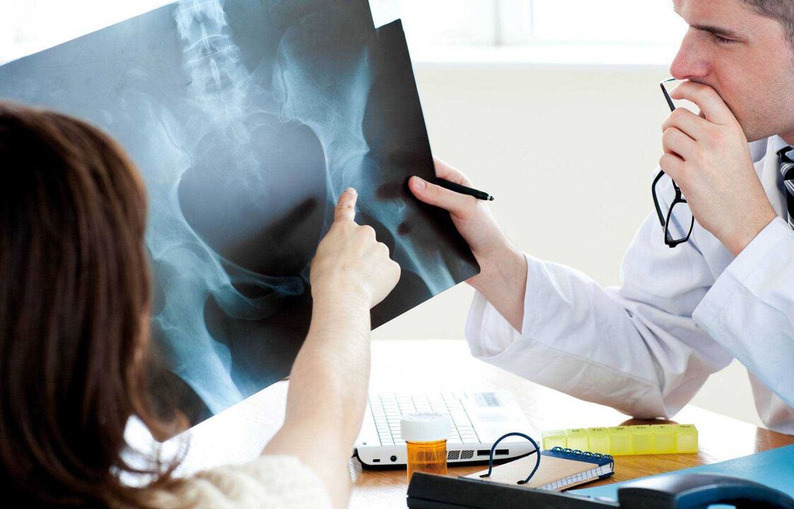 sinusuri ng mga doktor ang x-ray para sa hip arthrosis